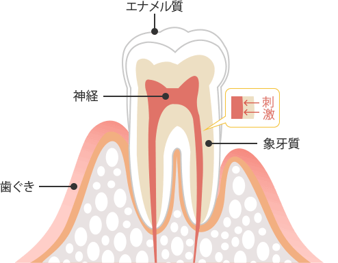 治し 方 過敏 知覚