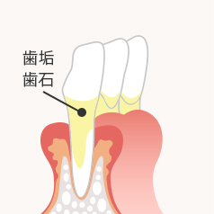 進行3